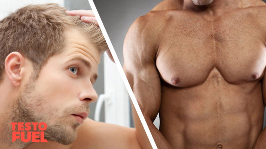 baldness-testosterone-feature