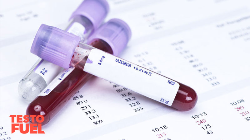 Blood test for low testosterone 