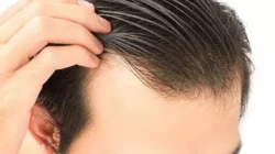 Can Low Testosterone Cause Hair Loss?